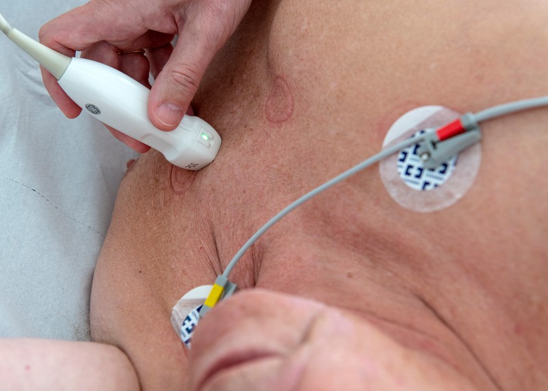 Echokardiographie | Kardiologie Dr. Brück, Erkelenz