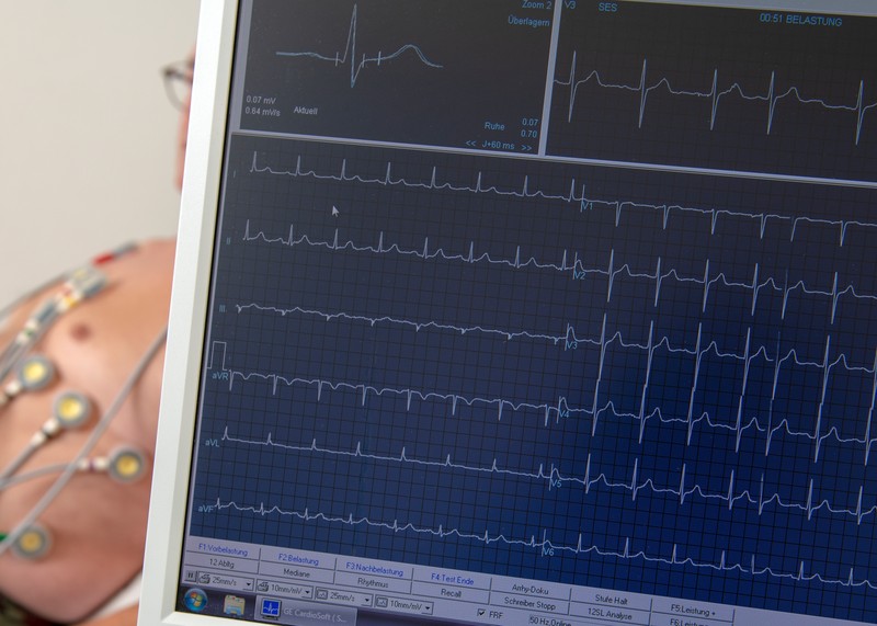 Leistungen: EKG | Kardiologie Dr. Brück, Erkelenz