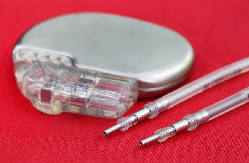 Schrittmacher- und ICD-Kontrollen | Kardiologische Praxis Erkelenz