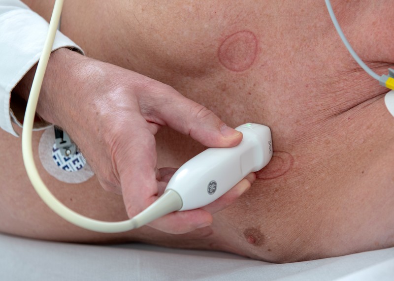 Stressechokardiografie | Kardiologie Dr. Brück, Erkelenz